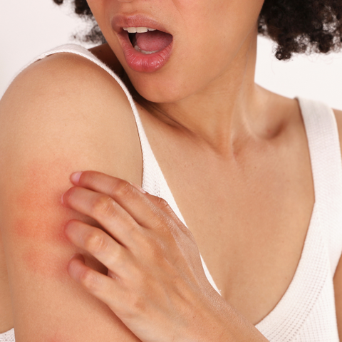 How Do You Know if You Have Sensitive Skin?