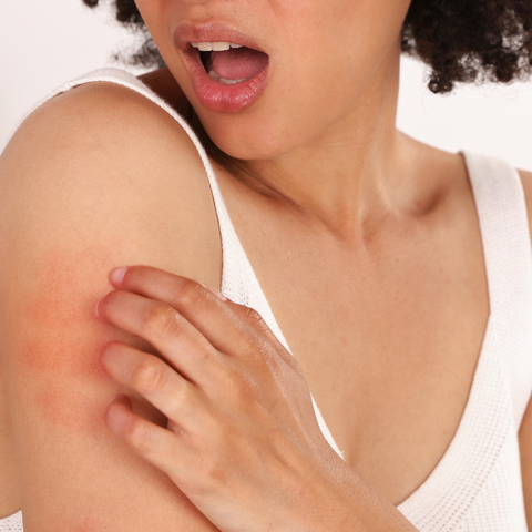 person scratching sensitive, irritated skin