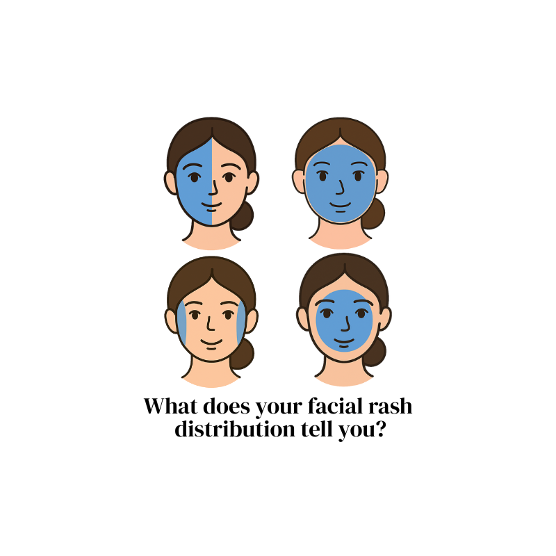 Understanding Facial Dermatitis: A Guide to Rash Distribution and Potential Skin Allergy Triggers